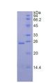 DSC1 / Desmocollin 1 Protein - Recombinant Desmocollin 1 By SDS-PAGE