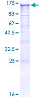 DSC2 / Desmocollin 2 Protein - 12.5% SDS-PAGE of human DSC2 stained with Coomassie Blue