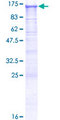 DSC2 / Desmocollin 2 Protein - 12.5% SDS-PAGE of human DSC2 stained with Coomassie Blue