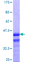 DSC2 / Desmocollin 2 Protein - 12.5% SDS-PAGE Stained with Coomassie Blue.