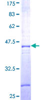 DSC2 / Desmocollin 2 Protein - 12.5% SDS-PAGE Stained with Coomassie Blue.