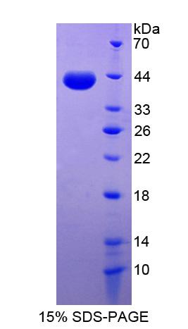 DSC2 / Desmocollin 2 Protein - Recombinant Desmocollin 2 By SDS-PAGE