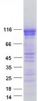 DSC2 / Desmocollin 2 Protein - Purified recombinant protein DSC2 was analyzed by SDS-PAGE gel and Coomassie Blue Staining