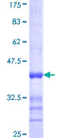 DSC3 / Desmocollin 3 Protein - 12.5% SDS-PAGE Stained with Coomassie Blue.