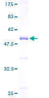 DSC92 / NGRN Protein - 12.5% SDS-PAGE of human NEUGRIN stained with Coomassie Blue