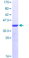 DSCAM Protein - 12.5% SDS-PAGE Stained with Coomassie Blue.