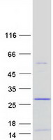 DSCR10 Protein - Purified recombinant protein DSCR10 was analyzed by SDS-PAGE gel and Coomassie Blue Staining