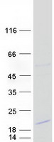 DSCR4 Protein - Purified recombinant protein DSCR4 was analyzed by SDS-PAGE gel and Coomassie Blue Staining
