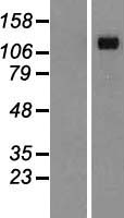 DSG4 / Desmoglein 4 Protein - Western validation with an anti-DDK antibody * L: Control HEK293 lysate R: Over-expression lysate