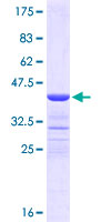 DSG4 / Desmoglein 4 Protein - 12.5% SDS-PAGE Stained with Coomassie Blue.
