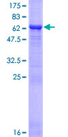DSN1 Protein - 12.5% SDS-PAGE of human DSN1 stained with Coomassie Blue