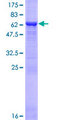 DSN1 Protein - 12.5% SDS-PAGE of human DSN1 stained with Coomassie Blue