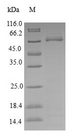 DSN1 Protein - (Tris-Glycine gel) Discontinuous SDS-PAGE (reduced) with 5% enrichment gel and 15% separation gel.