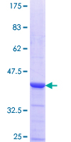 DSN1 Protein - 12.5% SDS-PAGE Stained with Coomassie Blue.