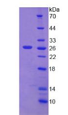 DSP / Desmoplakin Protein - Recombinant Desmoplakin By SDS-PAGE