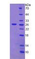 DSP / Desmoplakin Protein - Recombinant Desmoplakin By SDS-PAGE