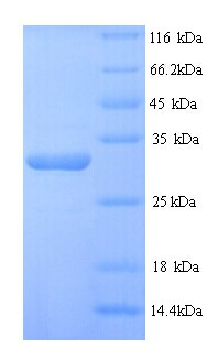 DSP / Desmoplakin Protein