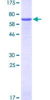 DSPG3 / Epiphycan Protein - 12.5% SDS-PAGE of human EPYC stained with Coomassie Blue