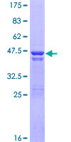 DSTN / Destrin Protein - 12.5% SDS-PAGE of human DSTN stained with Coomassie Blue