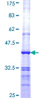 DSTN / Destrin Protein - 12.5% SDS-PAGE Stained with Coomassie Blue.