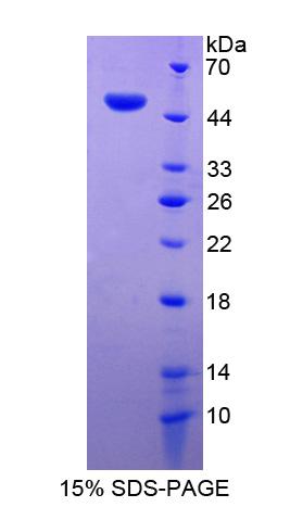 DSTN / Destrin Protein - Recombinant Destrin By SDS-PAGE