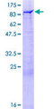 DSTYK / RIPK5 Protein - 12.5% SDS-PAGE of human DSTYK stained with Coomassie Blue