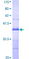 DSTYK / RIPK5 Protein - 12.5% SDS-PAGE Stained with Coomassie Blue.