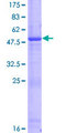 DTD1 Protein - 12.5% SDS-PAGE of human DTD1 stained with Coomassie Blue