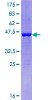 DTD2 Protein - 12.5% SDS-PAGE of human C14orf126 stained with Coomassie Blue
