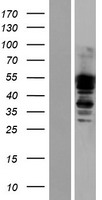 DTNA / Dystrobrevin Alpha Protein - Western validation with an anti-DDK antibody * L: Control HEK293 lysate R: Over-expression lysate