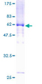 DTNA / Dystrobrevin Alpha Protein - 12.5% SDS-PAGE of human DTNA stained with Coomassie Blue