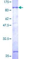 DTNB / Dystrobrevin Beta Protein - 12.5% SDS-PAGE of human DTNB stained with Coomassie Blue