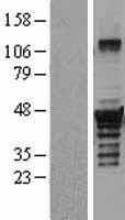 DTNBP1 / Dysbindin Protein - Western validation with an anti-DDK antibody * L: Control HEK293 lysate R: Over-expression lysate