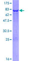 DTNBP1 / Dysbindin Protein - 12.5% SDS-PAGE of human DTNBP1 stained with Coomassie Blue
