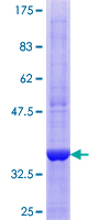 DTNBP1 / Dysbindin Protein - 12.5% SDS-PAGE Stained with Coomassie Blue.