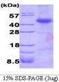 DTNBP1 / Dysbindin Protein