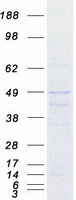 DTNBP1 / Dysbindin Protein - Purified recombinant protein DTNBP1 was analyzed by SDS-PAGE gel and Coomassie Blue Staining