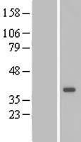 DTWD1 Protein - Western validation with an anti-DDK antibody * L: Control HEK293 lysate R: Over-expression lysate
