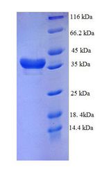 DTWD1 Protein