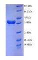 DTWD1 Protein