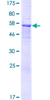 DTWD1 Protein - 12.5% SDS-PAGE of human DTWD1 stained with Coomassie Blue