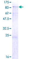 DTX1 / Deltex Protein - 12.5% SDS-PAGE of human DTX1 stained with Coomassie Blue