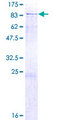 DTX1 / Deltex Protein - 12.5% SDS-PAGE of human DTX1 stained with Coomassie Blue
