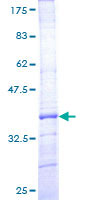 DTX1 / Deltex Protein - 12.5% SDS-PAGE Stained with Coomassie Blue.