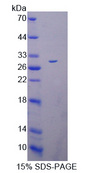 DTX1 / Deltex Protein - Recombinant  Deltex Homolog 1 By SDS-PAGE
