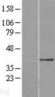 DTX3 Protein - Western validation with an anti-DDK antibody * L: Control HEK293 lysate R: Over-expression lysate
