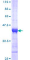 DTX3L Protein - 12.5% SDS-PAGE Stained with Coomassie Blue.