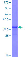 DUOX Protein - 12.5% SDS-PAGE Stained with Coomassie Blue.
