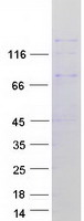 DUOX Protein - Purified recombinant protein DUOX1 was analyzed by SDS-PAGE gel and Coomassie Blue Staining