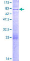 DUOXA1 / NIP Protein - 12.5% SDS-PAGE of human DUOXA1 stained with Coomassie Blue